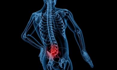 Juosmens osteochondrozės vystymosi priežastys
