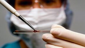 Arthrotų ir artrozės diagnozė