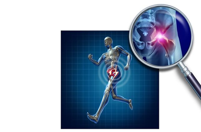 Skausmas, kai bėga klubo sąnarys